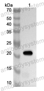 Anti-Human SLC22A6 Polyclonal Antibody