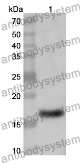 Anti-Human AMOT Polyclonal Antibody