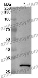 Anti-Human FNDC1 Polyclonal Antibody