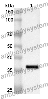 Anti-Human PDCD4/PD4 Polyclonal Antibody