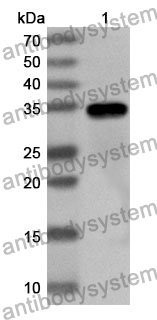 Anti-Human SEZ6 Polyclonal Antibody