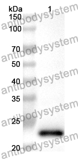 Anti-Human FNDC3B Polyclonal Antibody