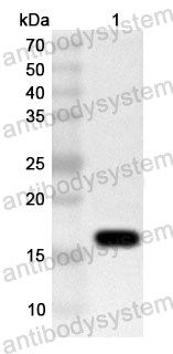 Anti-Human PLEKHO1 Polyclonal Antibody