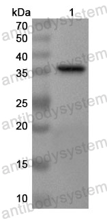 Anti-Human KLHL22 Polyclonal Antibody