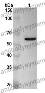 Anti-AGK Polyclonal Antibody