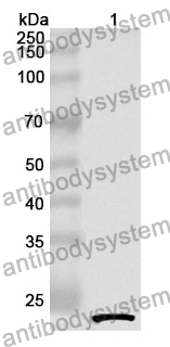 Anti-Human ARHGAP15 Polyclonal Antibody