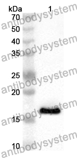 Anti-Human ODF2 Polyclonal Antibody