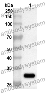 Anti-Human ZRANB3 Polyclonal Antibody