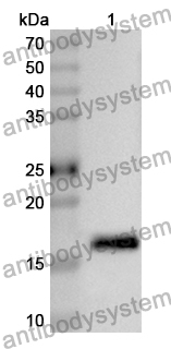 Anti-RNASE12 Polyclonal Antibody