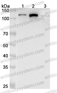 Anti-PITRM1 Polyclonal Antibody