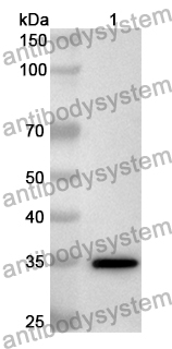 Anti-Human PLAC9 Polyclonal Antibody