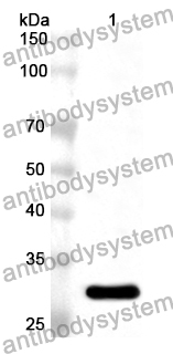 Anti-EPHA10 Polyclonal Antibody