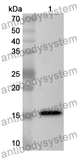 Anti-DEPDC1 Polyclonal Antibody