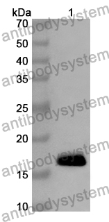 Anti-LGALS9C Polyclonal Antibody