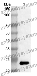 Anti-ZFAND6 Polyclonal Antibody