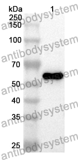 Anti-MAST2 Polyclonal Antibody