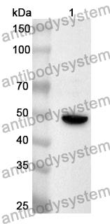 Anti-PLB1 Polyclonal Antibody