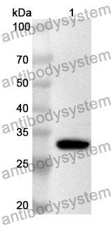 Anti-CC2D1A Polyclonal Antibody