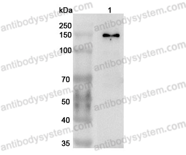 Anti-ATAD2 Polyclonal Antibody