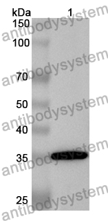 Anti-ATAD2 Polyclonal Antibody