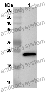 Anti-CPLX2 Polyclonal Antibody