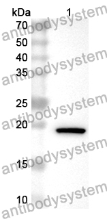 Anti-Human POTEG Polyclonal Antibody