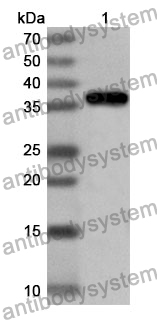 Anti-Human CRTC1 Polyclonal Antibody