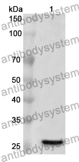 Anti-IL27RA Polyclonal Antibody