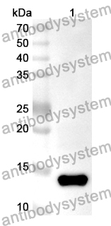 Anti-OLFM4 Polyclonal Antibody