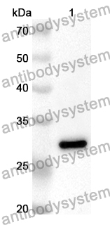 Anti-IL20RB Polyclonal Antibody