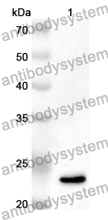 Anti-SOSTDC1 Polyclonal Antibody