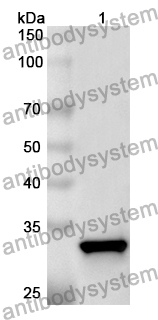 Anti-Human IKBIP Polyclonal Antibody