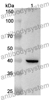 Anti-FBN3 Polyclonal Antibody