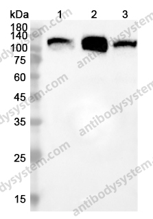 Anti-SND1 Polyclonal Antibody