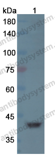 Anti-RRM2B Polyclonal Antibody