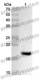 Anti-DYM Polyclonal Antibody