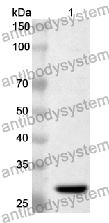 Anti-NOTCH2NLA Polyclonal Antibody