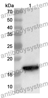 Anti-Human GDF7 Polyclonal Antibody