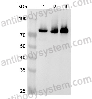 Anti-Human METTL3 Polyclonal Antibody