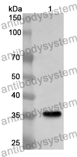 Anti-LDB1 Polyclonal Antibody