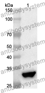 Anti-Human ITIH5 Polyclonal Antibody