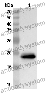 Anti-ADIPOR2 Polyclonal Antibody