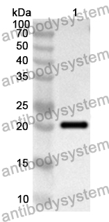 Anti-Human GKN2 Polyclonal Antibody