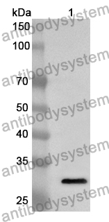 Anti-ANGPTL5 Polyclonal Antibody