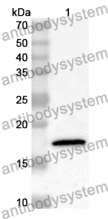 Anti-XYLT1 Polyclonal Antibody