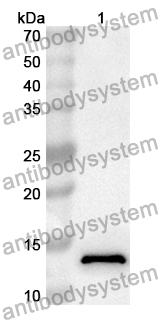 Anti-SLC30A8 Polyclonal Antibody