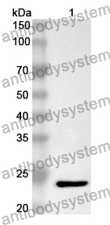 Anti-SLC30A8 Polyclonal Antibody