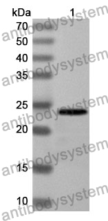 Anti-SCUBE3 Polyclonal Antibody