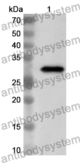 Anti-MYOCD Polyclonal Antibody