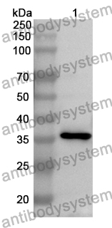 Anti-DOCK4 Polyclonal Antibody